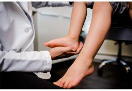 Что такое вальгус стопы у детей: причины, симптомы и прогноз