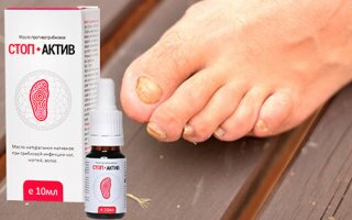 Противогрибковое масло Стоп-Актив: состав, эффективность и аптечные аналоги