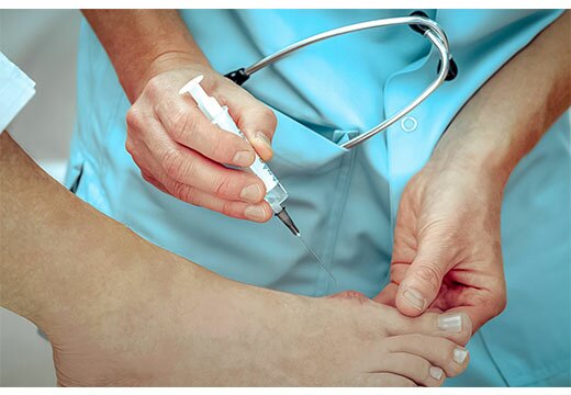 Укол в стопу